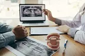 Pantomogram zębów (szczęki) – kiedy wykonuje się ten zabieg?